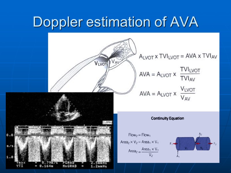 Doppler estimation of AVA